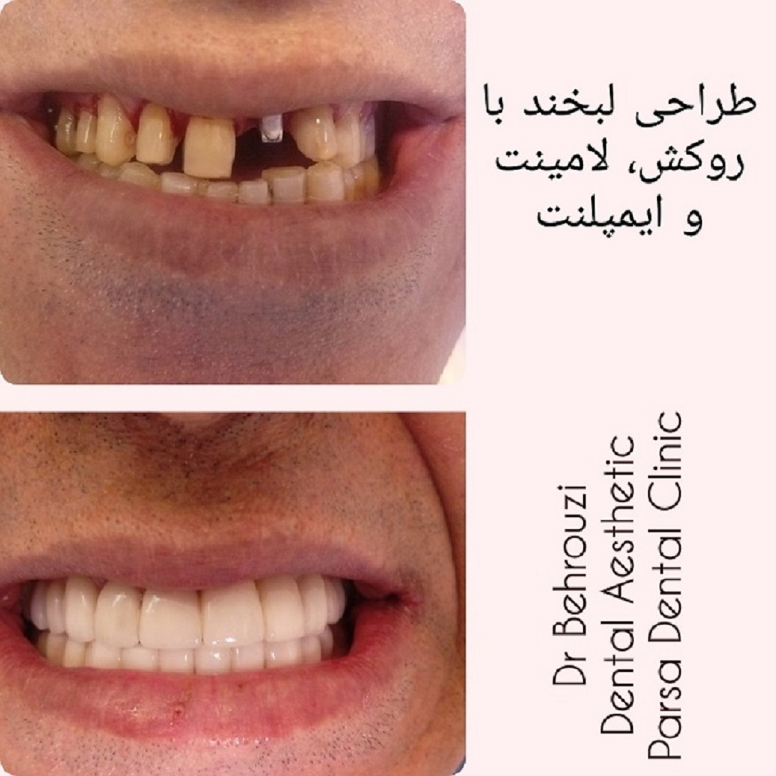 تصویر 1